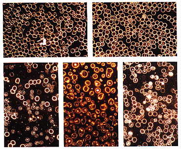 Dark Field Microscopy - www.serafin.ch